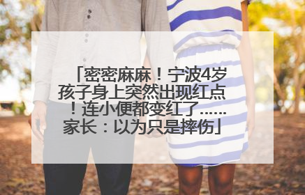密密麻麻！宁波4岁孩子身上突然出现红点！连小便都变红了……家长：以为只是摔伤